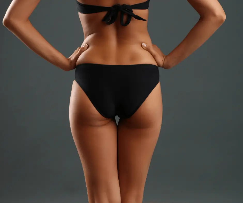 The back of a woman in a black bikini undergoing Smartlipo treatment.