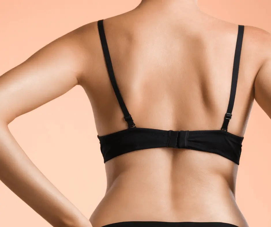 The back of a woman wearing a black bra, showcasing her sculpted figure and the results of body contouring.