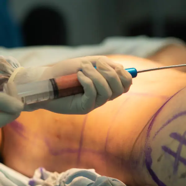 A man is getting a syringe injected into his stomach.