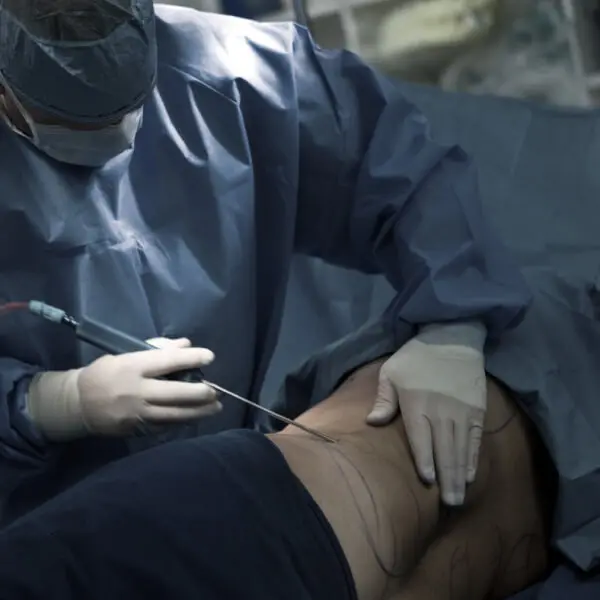 A surgeon is performing stomach surgery on a patient in an operating room.