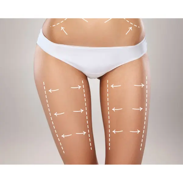 Thigh Liposuction NYC  Reshape Your Lower Body