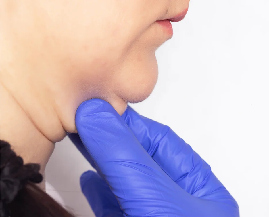 A woman undergoing chin liposuction.