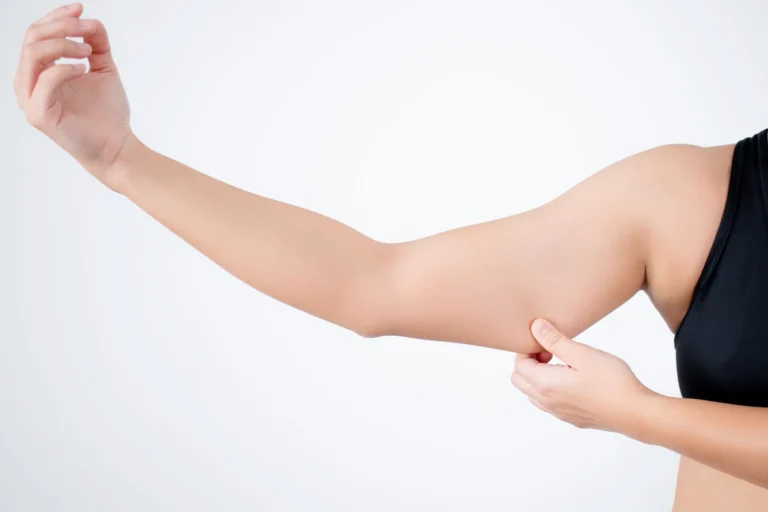 A woman is pointing at her arm during a transaxillary brachioplasty procedure.