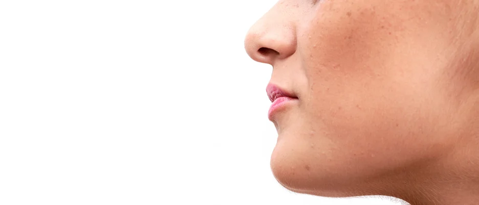 A close up of a woman's chin undergoing non-invasive fat reduction treatments.