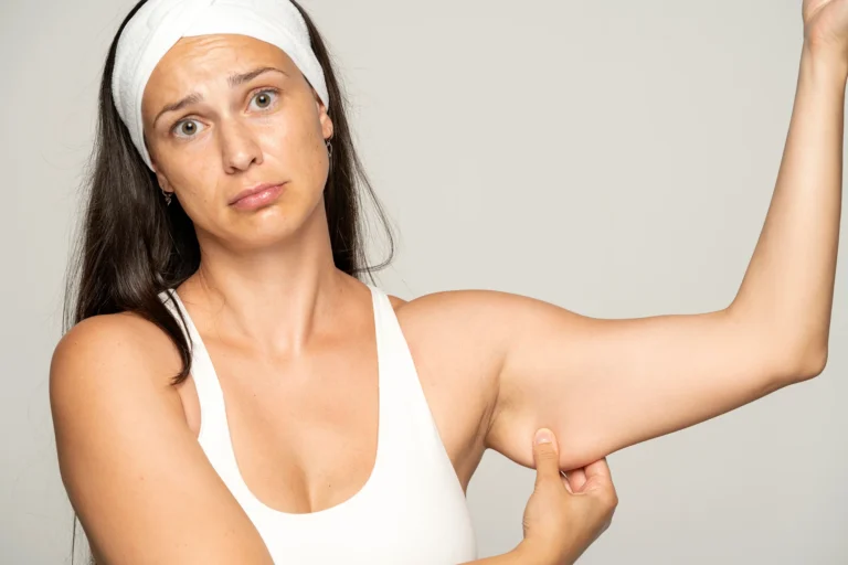 A woman is flexing her toned arm after liposuction procedure