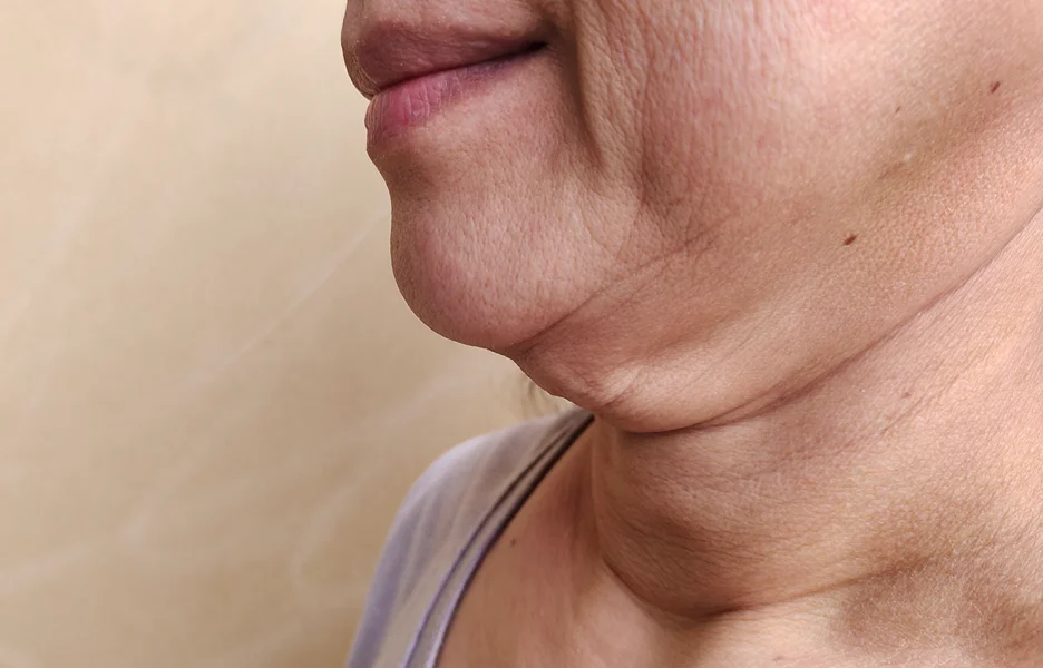 A recovering woman's chin and neck under expert supervision.