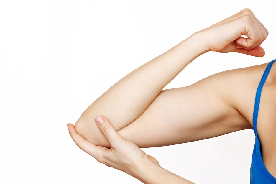 A Closer Look of a Woman's Arm after Brachioplasty Procedure