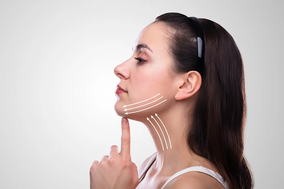 A woman's face with lines on her neck receives chin liposuction for a sculpted look.