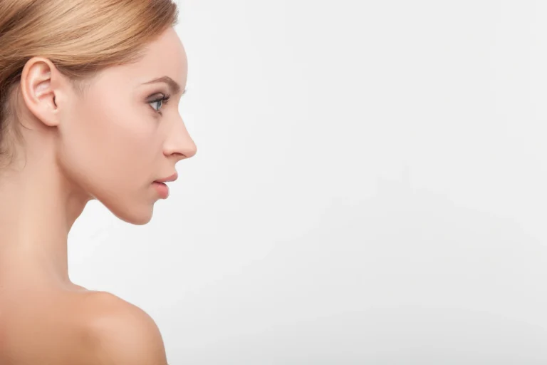 After Chin Lipo, a woman's side view of her face.