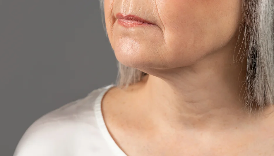 A patient over 60 showing her chin