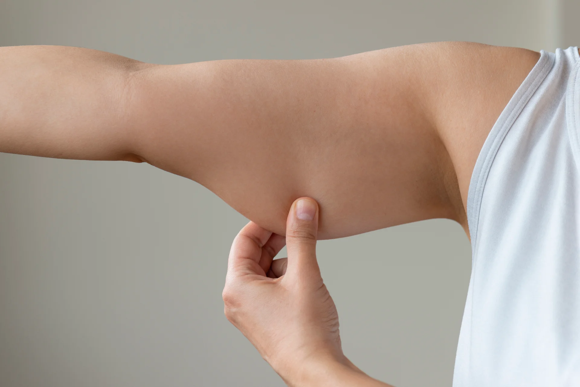 A person pinching the skin on their upper arm, focusing on body fat measurement during arm liposuction recovery.