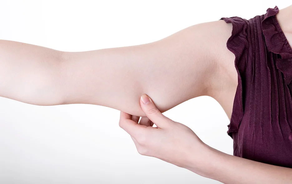A Woman pinching her arm before arm liposuction